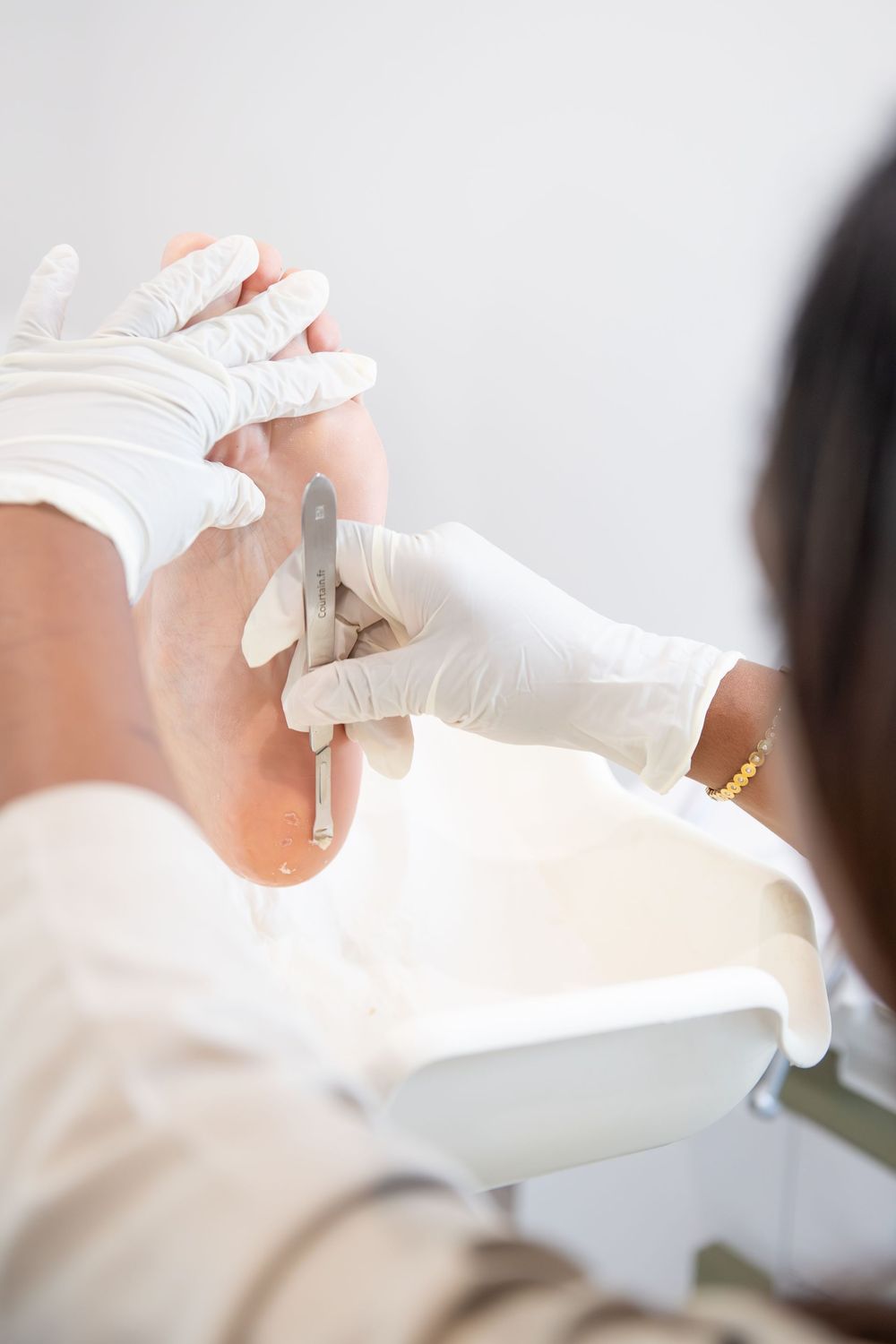 Soin de pédicurie médicale au bistouri, mains gantées